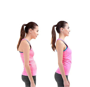 comparison of a woman's posture with text 'Permanent Effect' and 'Smile with Confidence'.