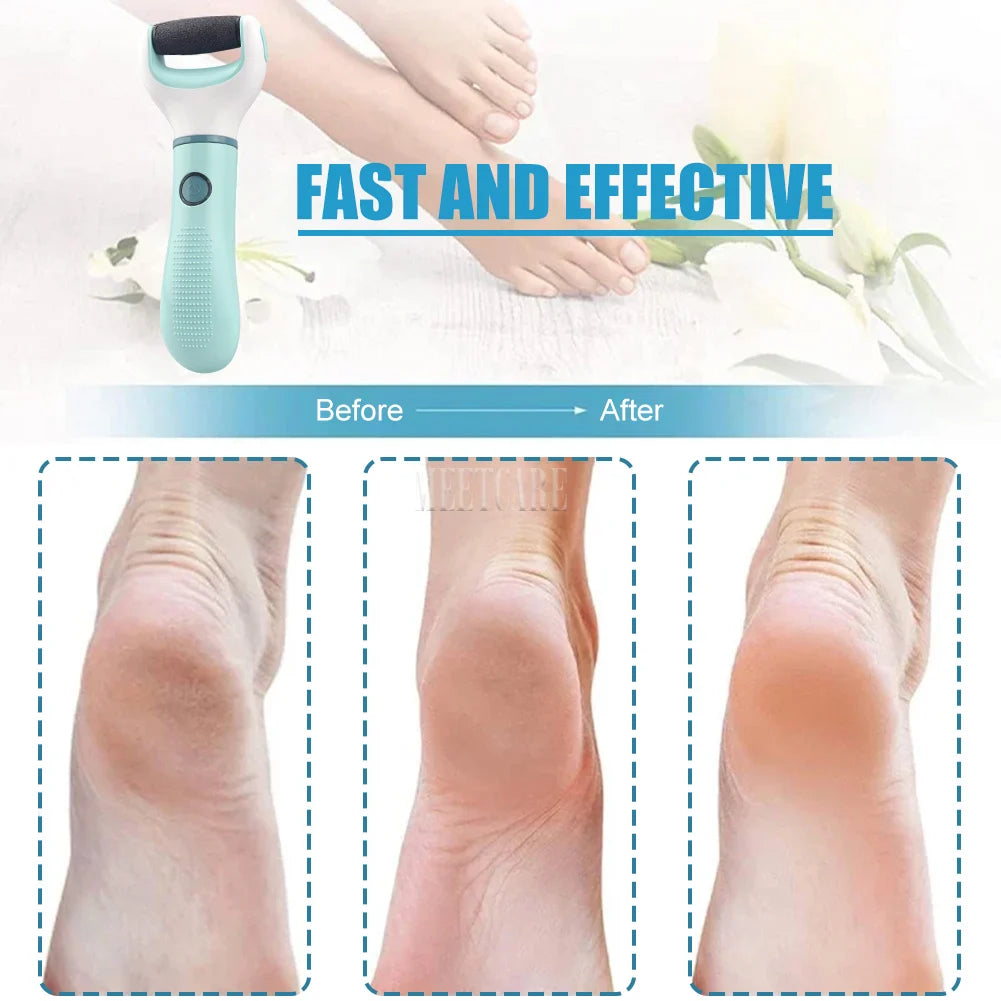 Foot care tool with 'Fast and Effective' text and before-and-after comparison of foot skin texture.